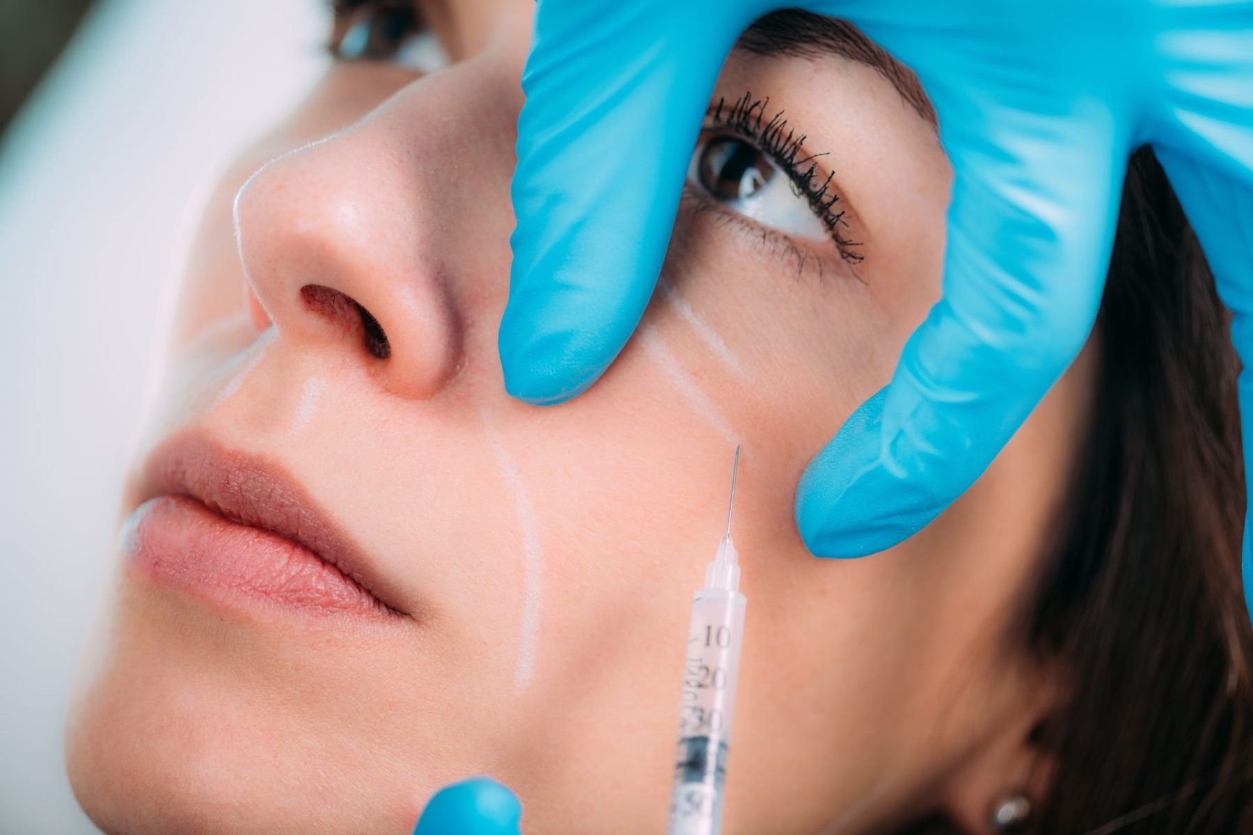 anti-aging-treatment-dermal-filler-injection-2023-11-27-05-17-17-utc