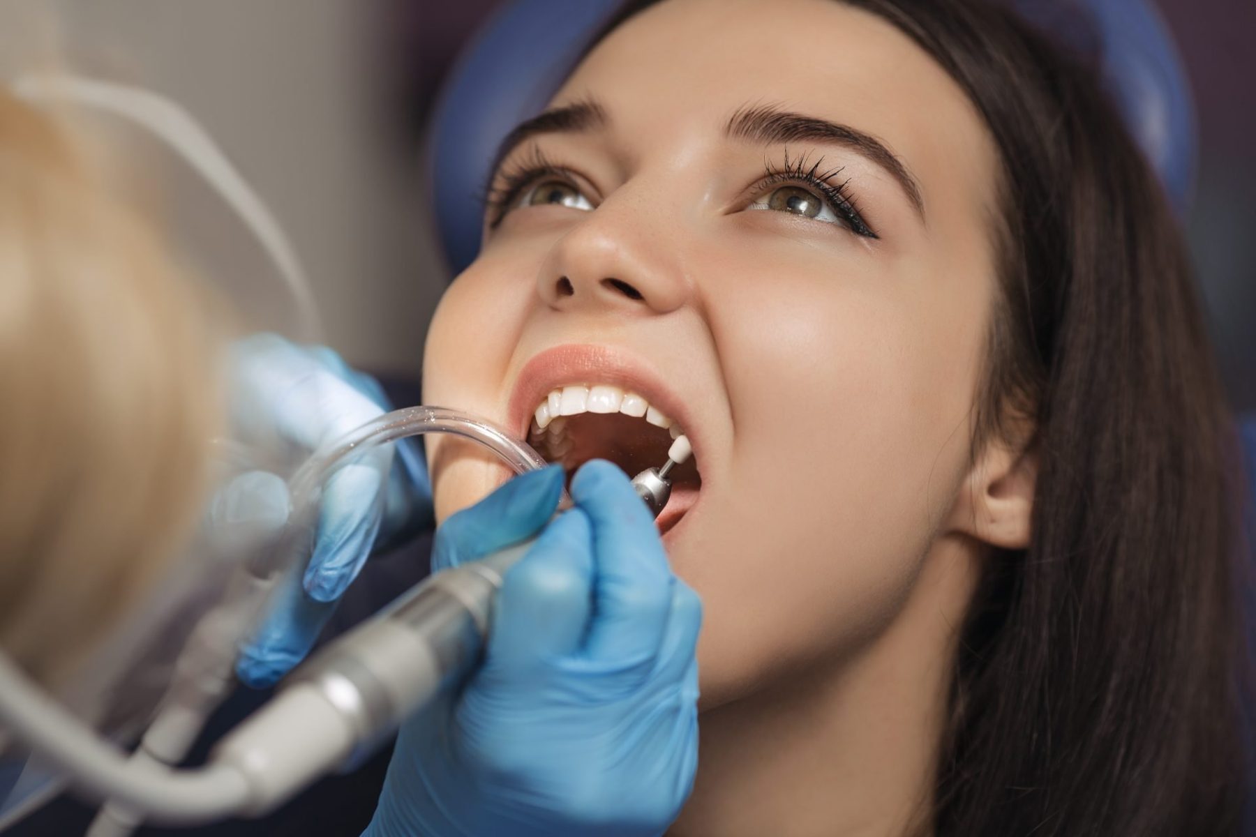 dentist-polishing-patient-teeth-at-the-dental-offi-2023-11-27-05-33-53-utc