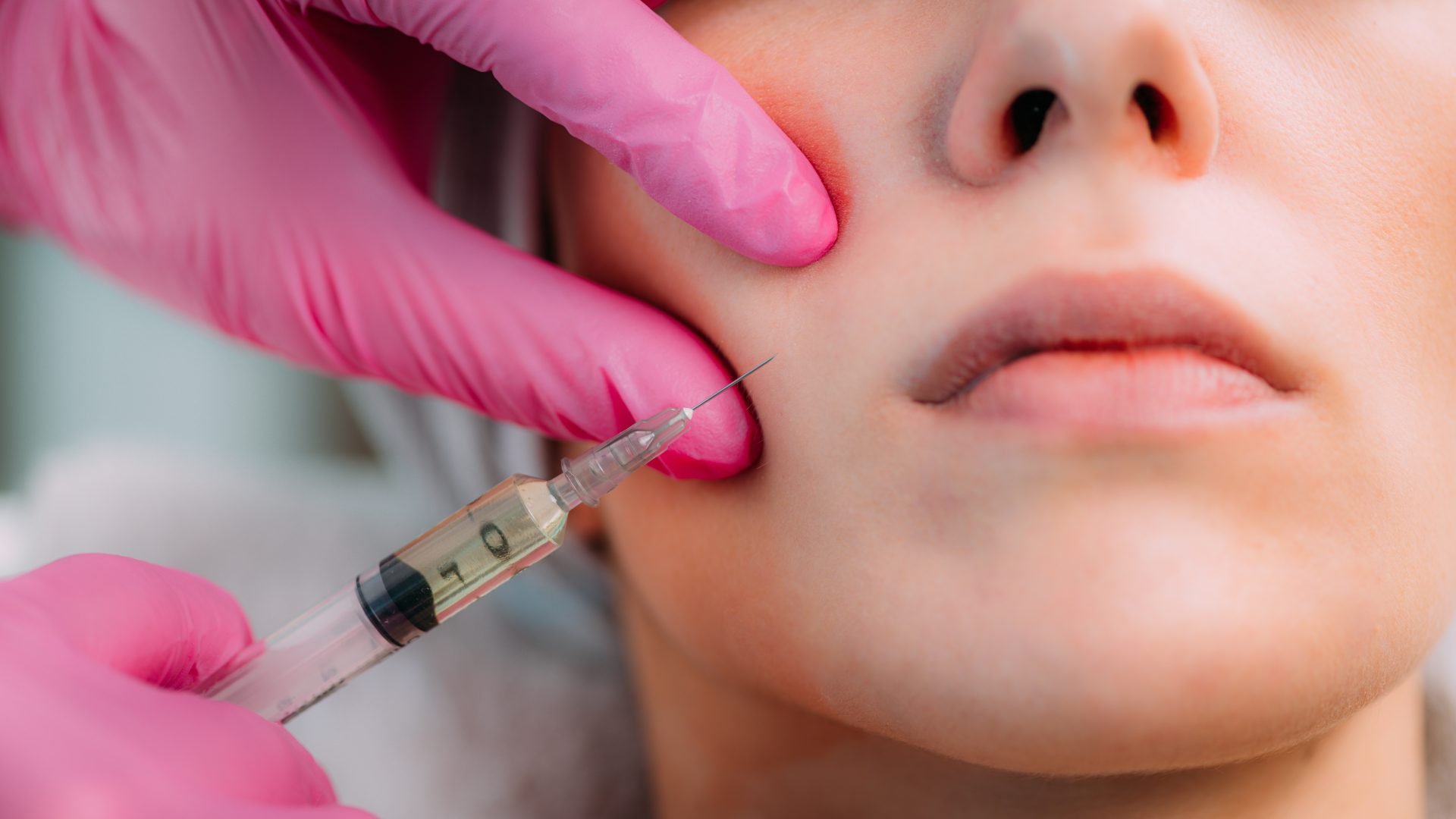 dermal-filler-injection-for-cheeks-2023-11-27-05-11-21-utc