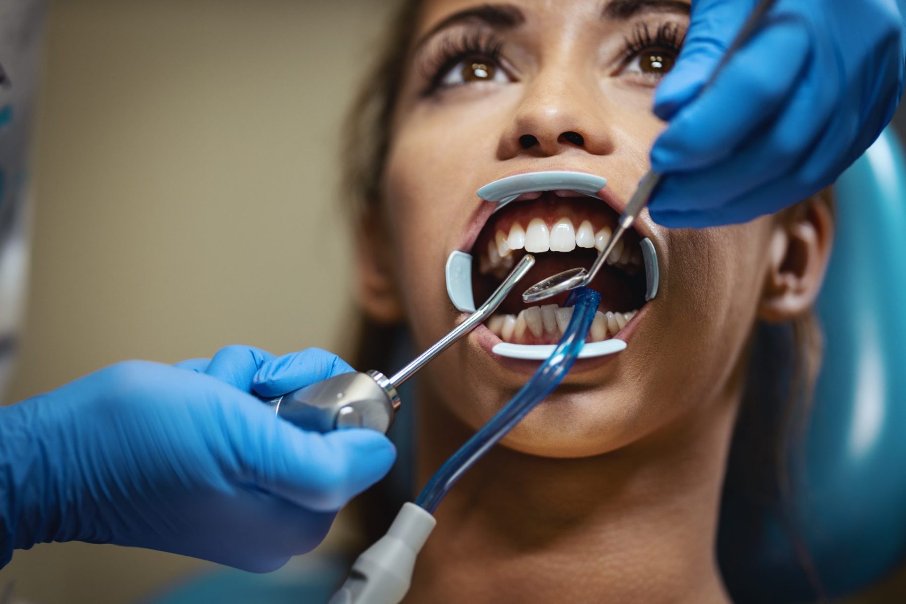 for-the-most-beautiful-teeth-2023-11-27-04-57-46-utc