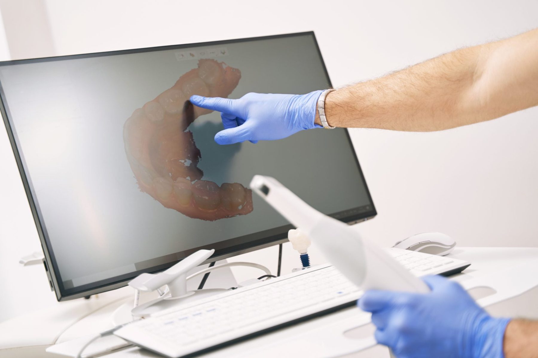 male-dentist-hand-pointing-at-computer-display-wit-2023-11-27-05-23-35-utc