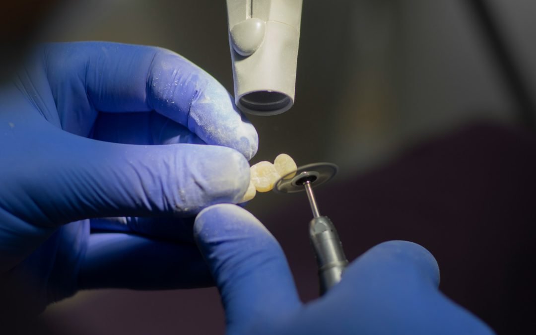 Dental Implants: The Ultimate Solution for Missing Teeth