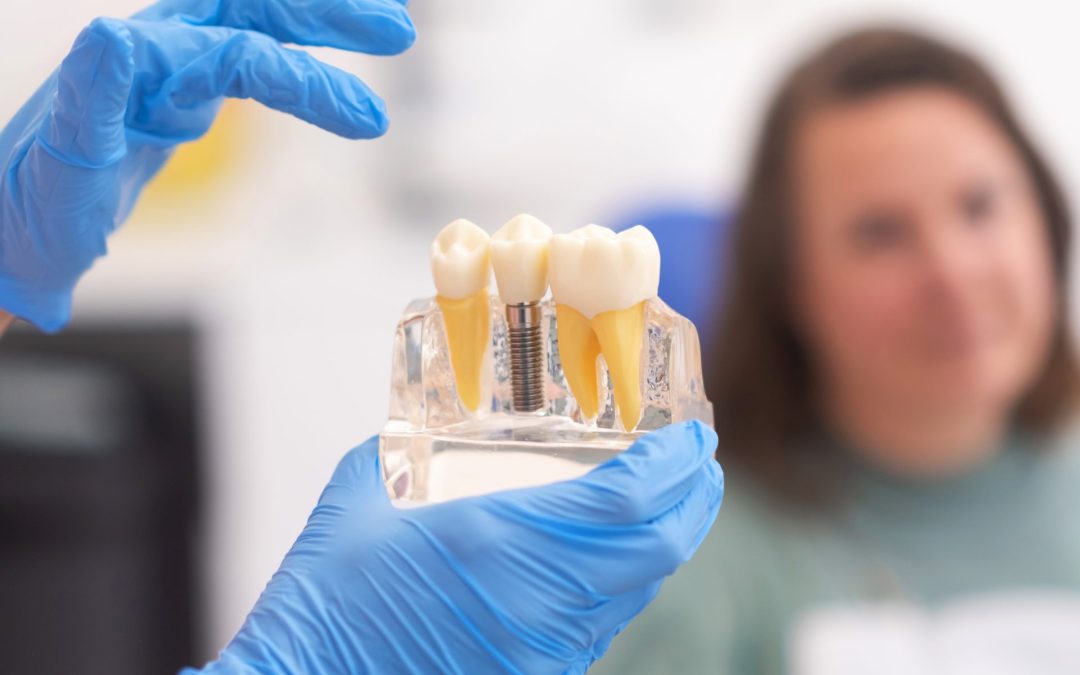 How to Choose the Right Type of Dental Implant for You