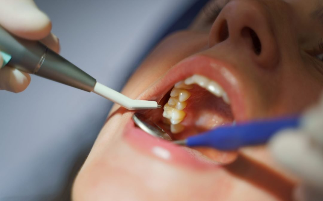 The Importance of Preventative Care in General Dentistry for a Healthy Smile