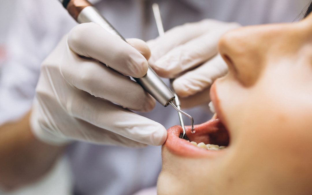 Common Myths and Misconceptions about General Dentistry