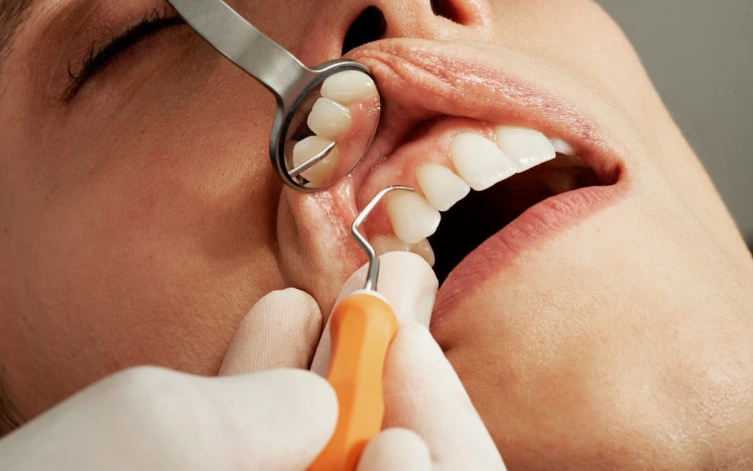 Common Problems with Dental Implants and Their Solutions
