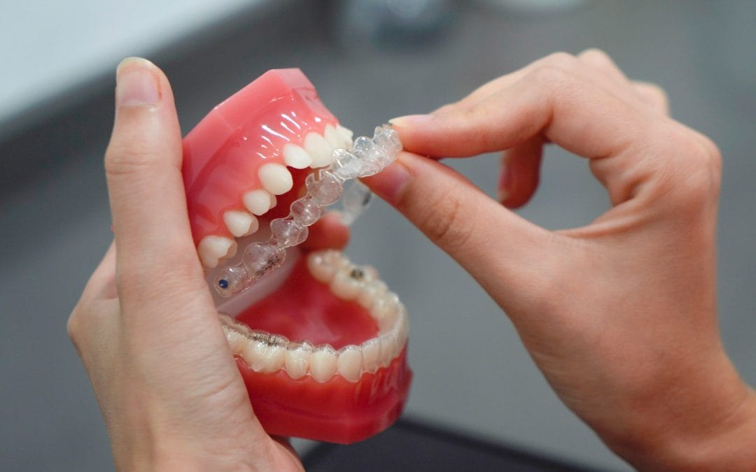 How to Choose the Best Invisalign Provider