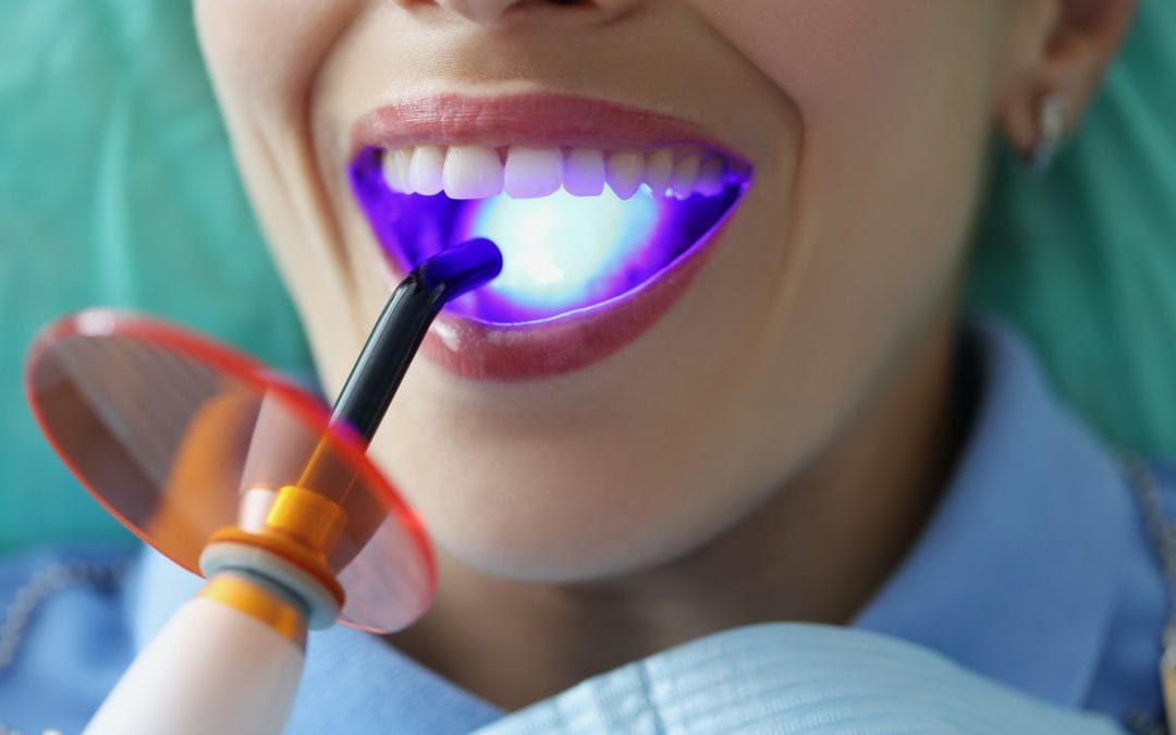 Everything You Should Know About Cosmetic Dentistry in Chesham