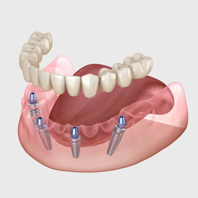 Private Dentist Hemel Hempstead - Boxmoor House Dental Practice