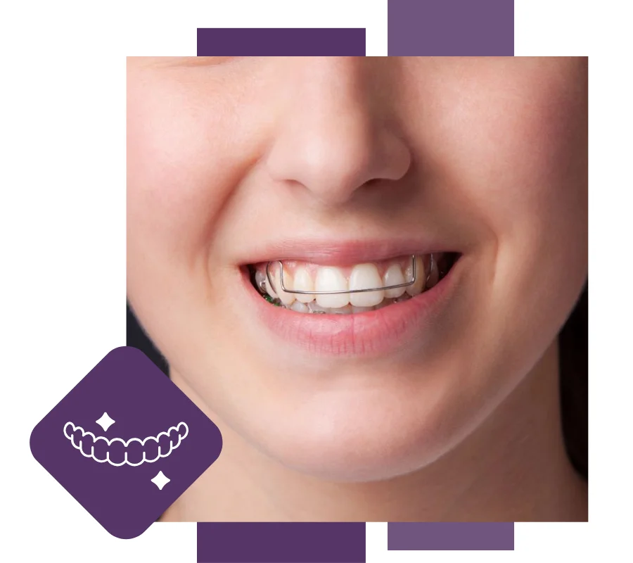 girl wearing aligners