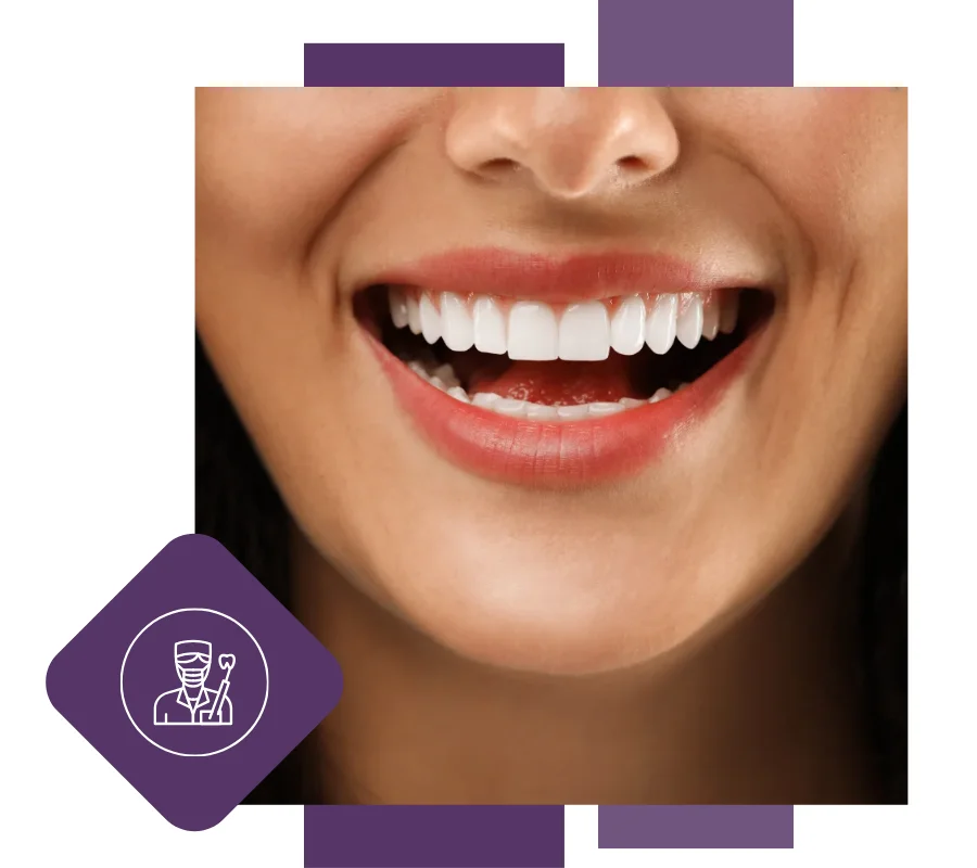 smiling lady after smile makeover