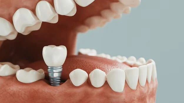 Can Dental Implants Be Done in One Day?