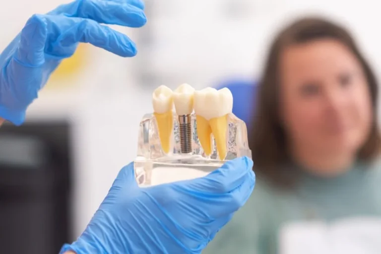 How to Choose the Right Type of Dental Implant for You