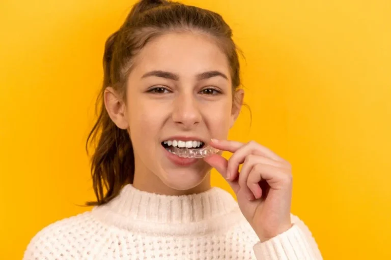 Invisalign: A Modern Approach to Straightening Your Teeth