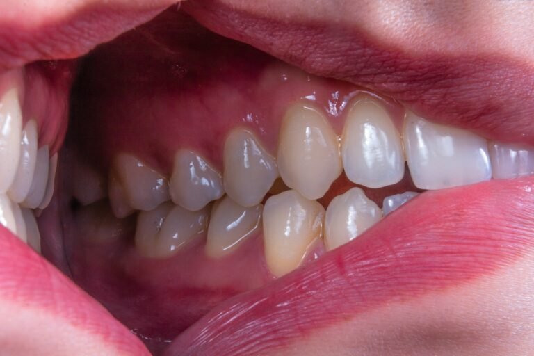 Teeth