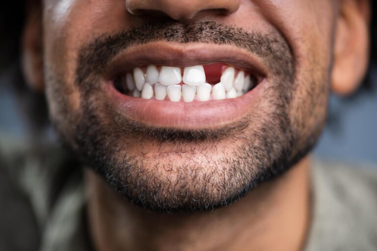 Missing Tooth